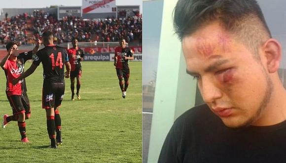 Universitario que denunció a jugadores del FBC Melgar presenta video de agresión
