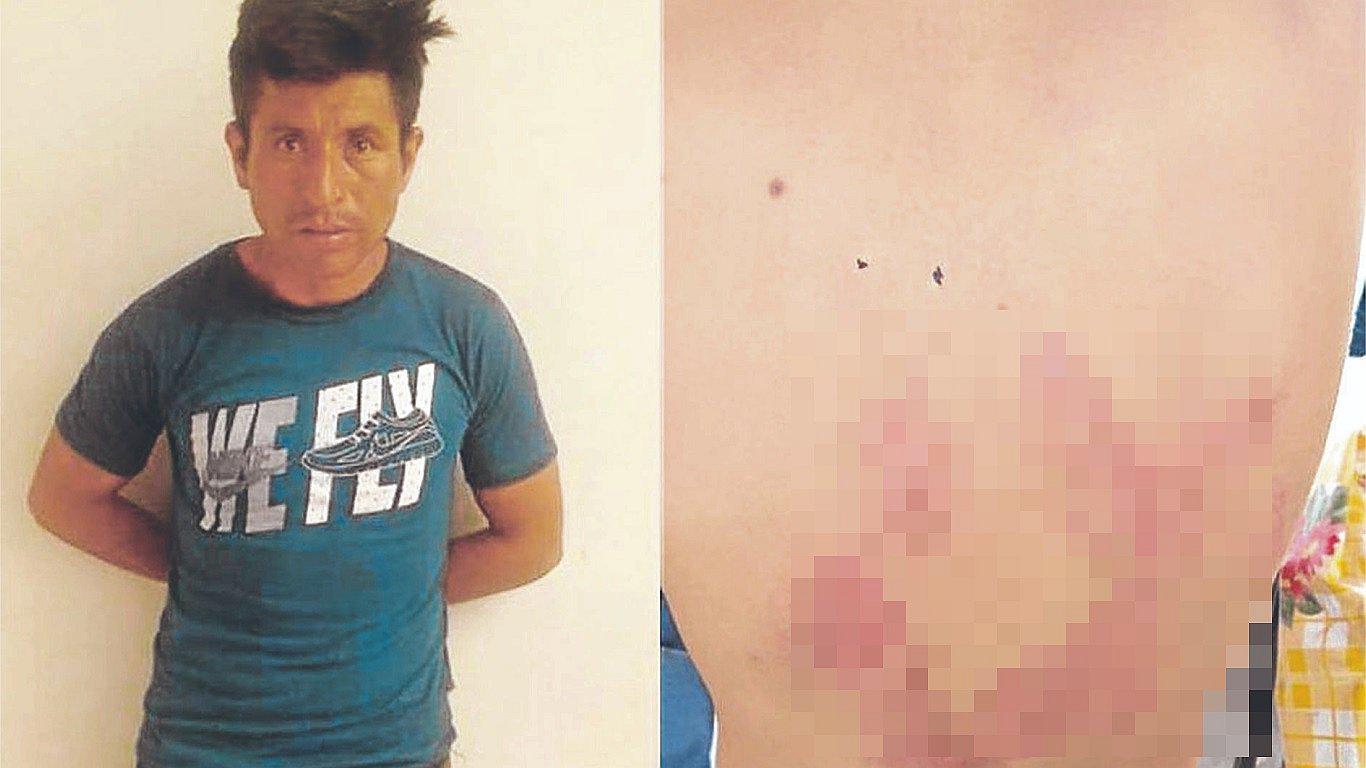 Obrero golpea con hebilla de correa a su hijo de seis años por no saber hacer la tarea