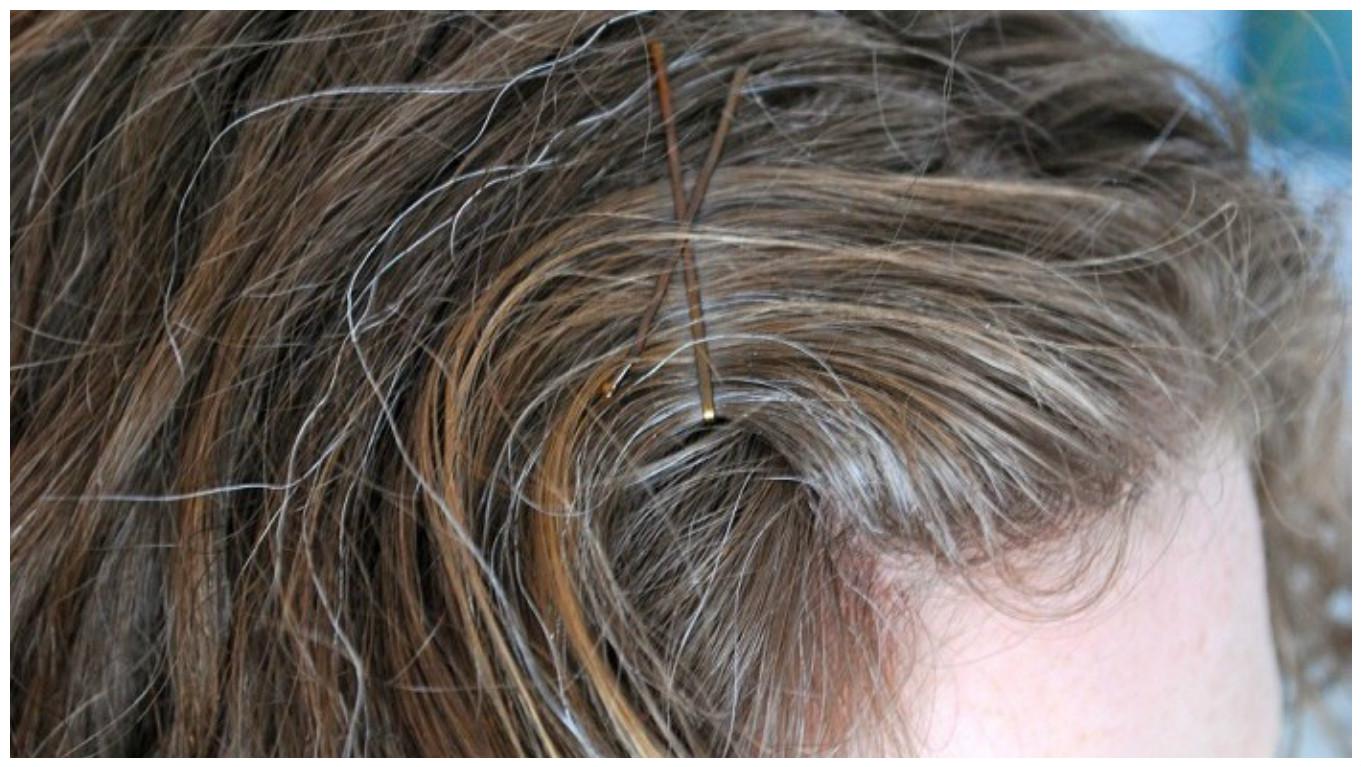  Identifican el primer gen vinculado al encanecimiento del cabello