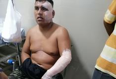 Chiclayo: Obrero se quema con vapor de agua hervida al pelar un chancho