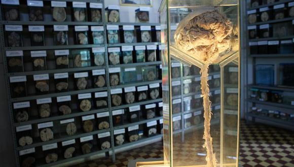 Museo del Cerebro. (Foto: Instituto Nacional de Ciencias Neurológicas)