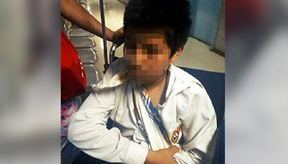 Bullying: escolares  fracturan clavícula de compañero en colegio de Tacna