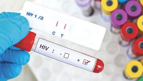 Primera vacuna capaz de prevenir el VIH estaría lista en 2023