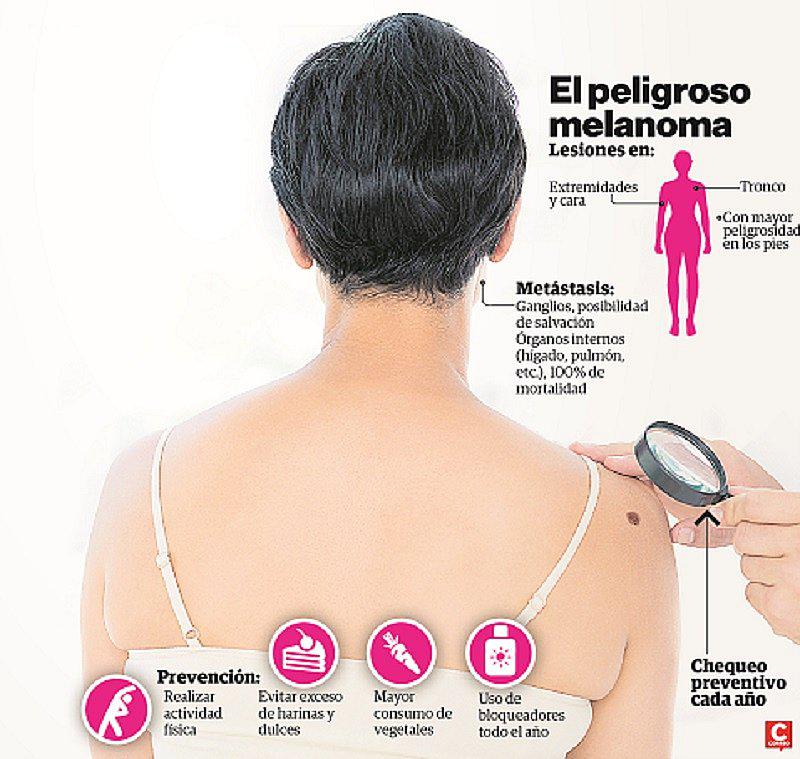 Cáncer de piel: 70% de pacientes llega con mal en estado avanzado