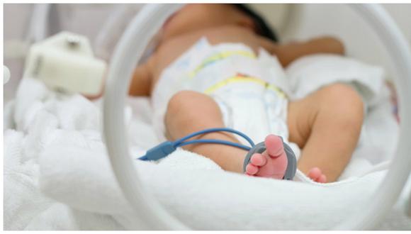 Una guía rápida de todo lo que debes saber si tienes un bebé prematuro
