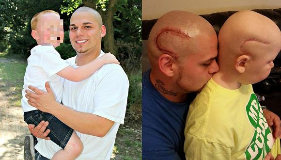 Gabriel Marshall: muere el niño cuyo padre se tatuó una cicatriz para hacerlo sentir mejor (FOTOS)