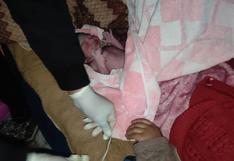 Tacna: Policías parteros utilizan cúter para separar a madre e hija
