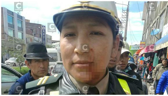 Huancayo: Sujeto ataca y le corta la cara a policía con un cuchillo (VIDEO)