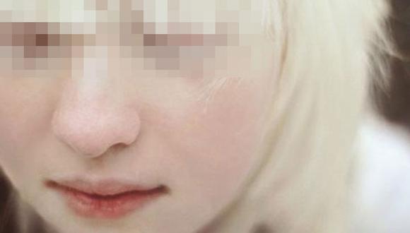 Dos médicos habrían asesinado a machetazos a mujer albina