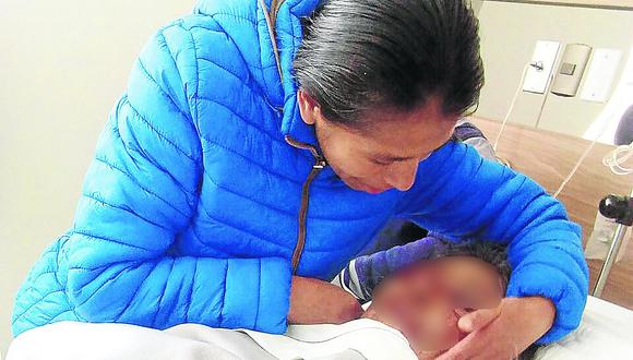 Médicos reconstruyen los párpados a mujer que fue atacada por su hijo 