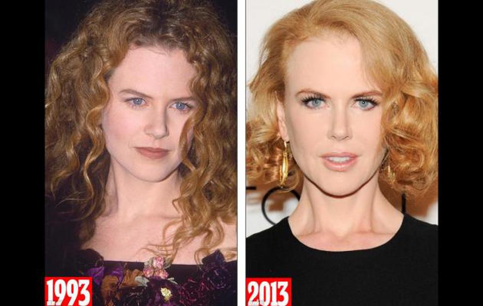 Mira el antes y el después de Nicole Kidman (FOTOS)