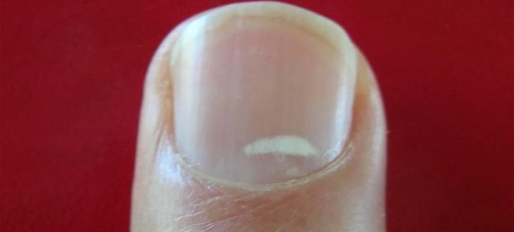 Esta es la verdad sobre las manchas blancas en las uñas 