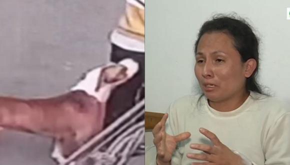Madre y su hijo con autismo resultan heridos tras ataque de perro pitbull en El Agustino. (Captura: América Noticias)