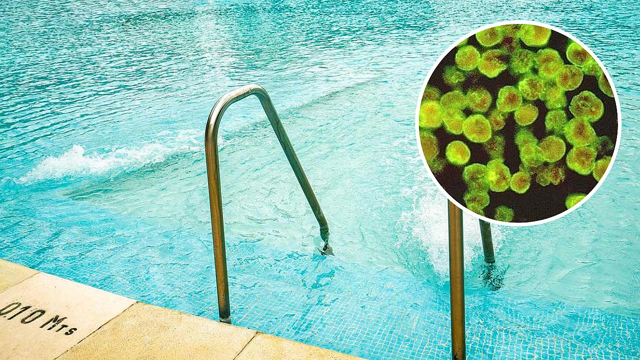 'Ameba come cerebros': Esto es todo lo que tienes que saber de ella 