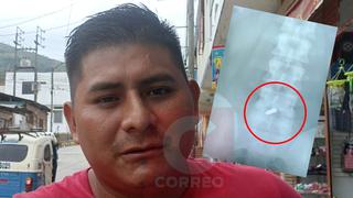 Pichanaqui: Hombre vive con bala en la columna y pide ayuda para realizarse una cirugía