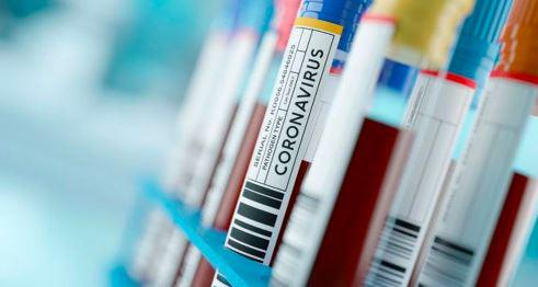 Casos por coronavirus se elevaron en el Perú. (Foto: GEC)