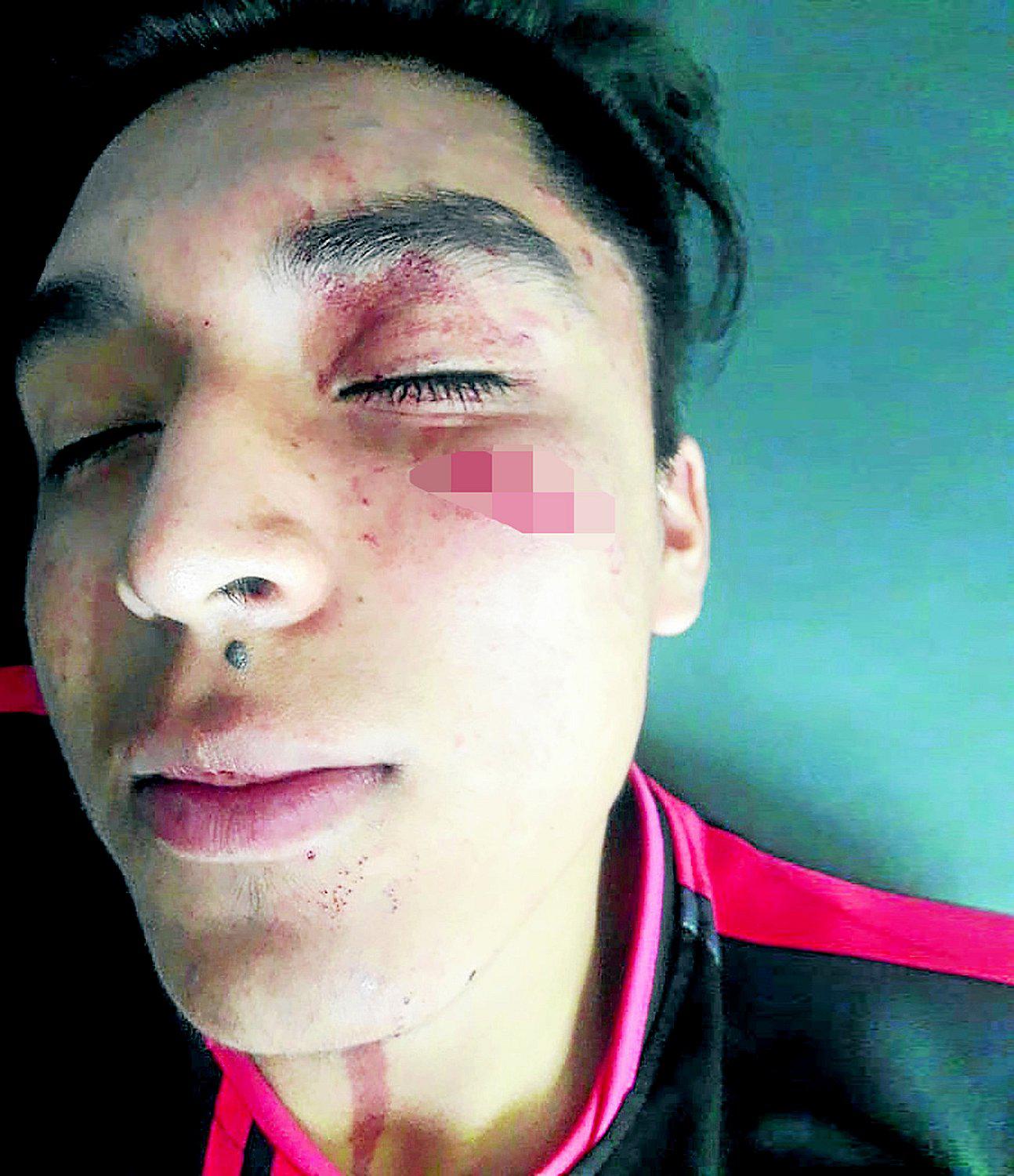 Venezolano propina golpiza a universitario en encuentro de fulbito 