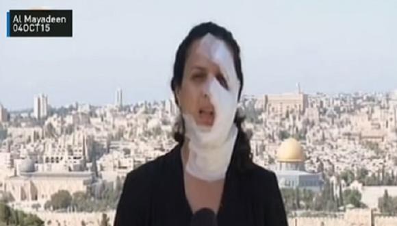 YouTube: Periodista herida en ataque israelí y así emite informe en directo (VIDEO)