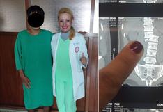 Nuevo Chimbote: Menor vuelve a caminar tras ser sometido a delicada operación en la columna