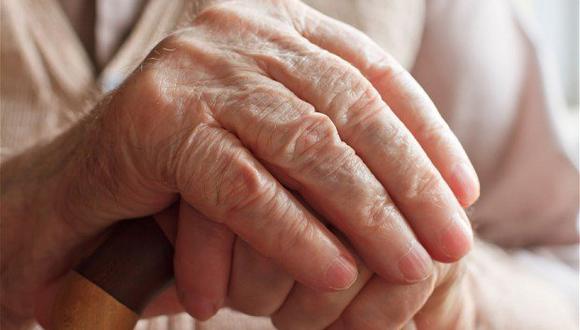  Alzhéimer: Una proteína de enfermedad puede transmitirse en procedimientos médicos