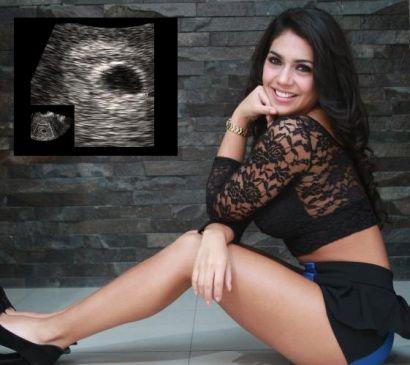 Vania Bludau estaría embarazada