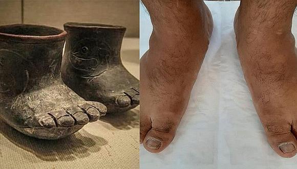 Alcalde de Moche usa cuenta oficial de la comuna para compar sus pies con la de una cerámica Moche 