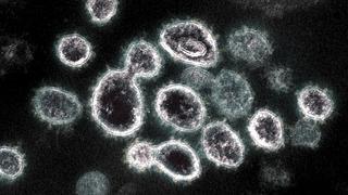 Descubren “punto débil” del coronavirus que evitaría se multiplique en el organismo