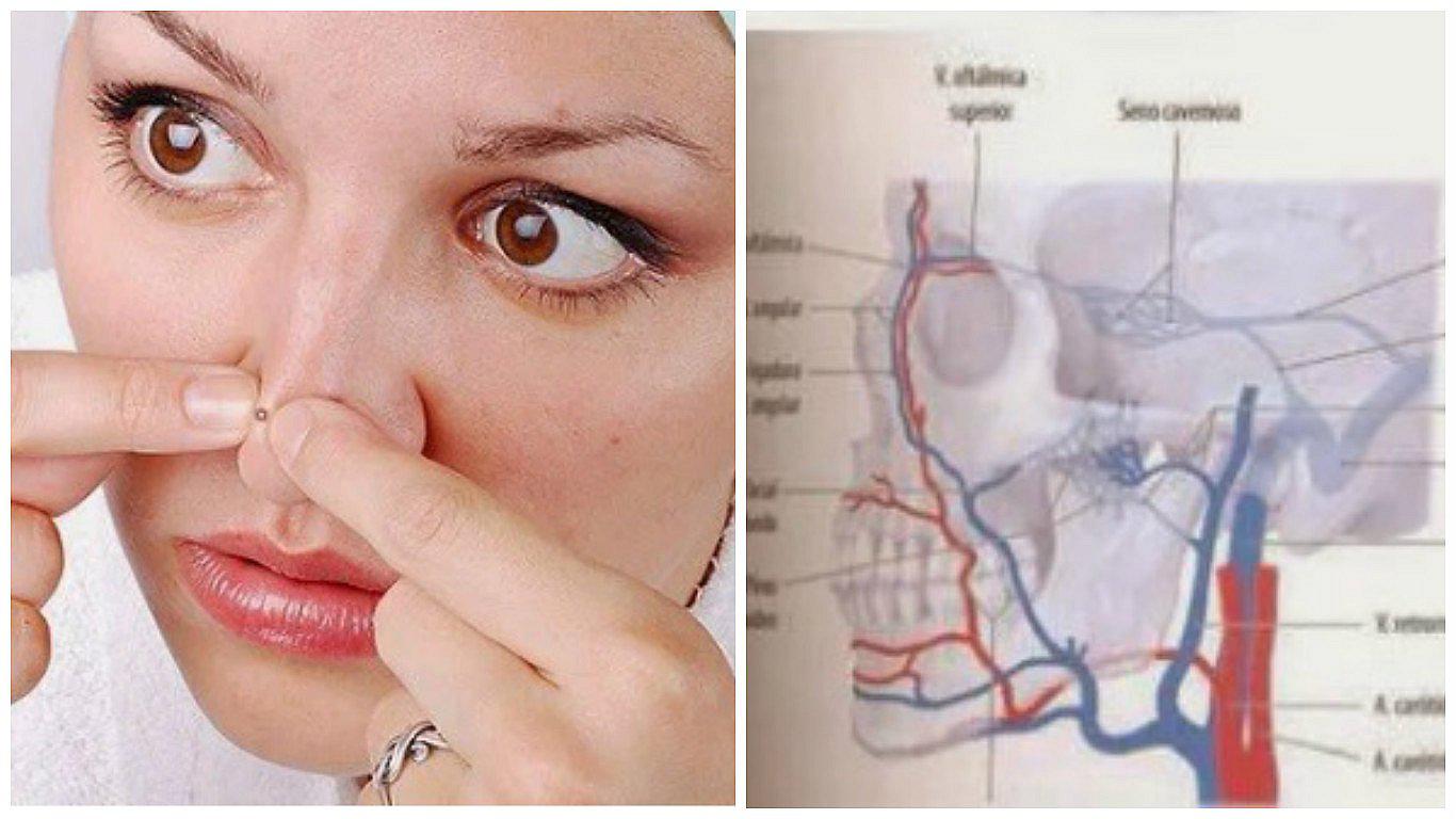 Sacarte un granito de esta zona de la cara podría ocasionar la muerte