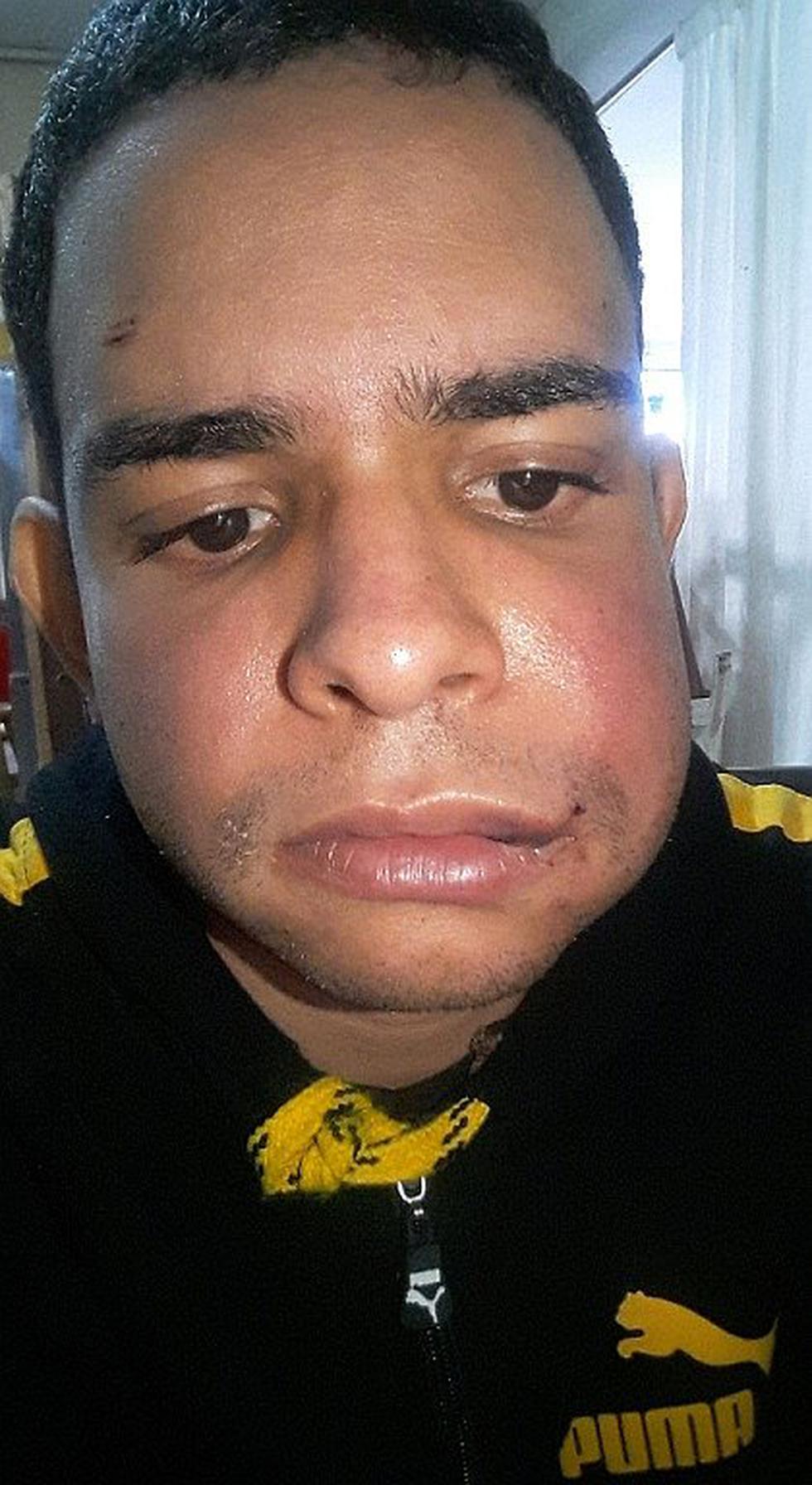 Venezolano es agredido brutalmente por barristas del Sports Boys (FOTOS)