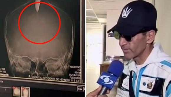 Hombre sobrevivió con cuchillo incrustado en la cabeza y se trasladó solo al hospital (VIDEO)