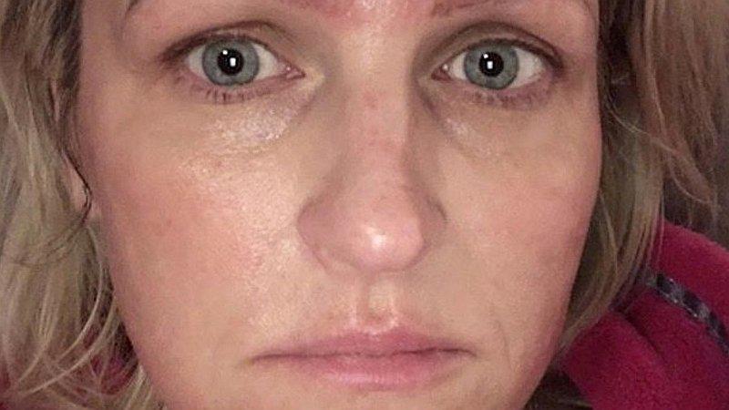 Mujer se hizo un tratamiento de belleza en oferta y terminó con cuatro cejas (FOTOS)