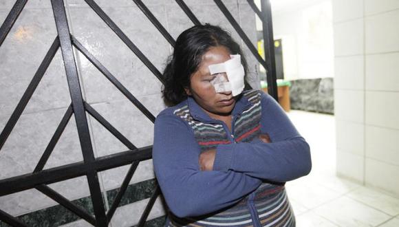 Mujer fue salvajemente golpeada por su cuñado