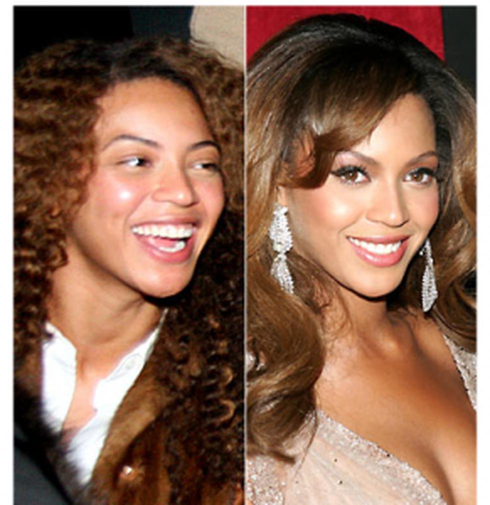 (FOTOS) Famosas antes y después de la rinoplastia