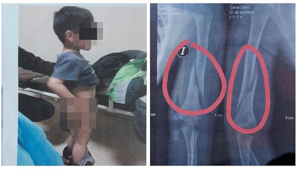Cae acusado de golpear a su hijastro de cuatro años hasta romperle el brazo 