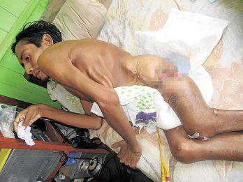 Postrado en cama hace más de 4 años