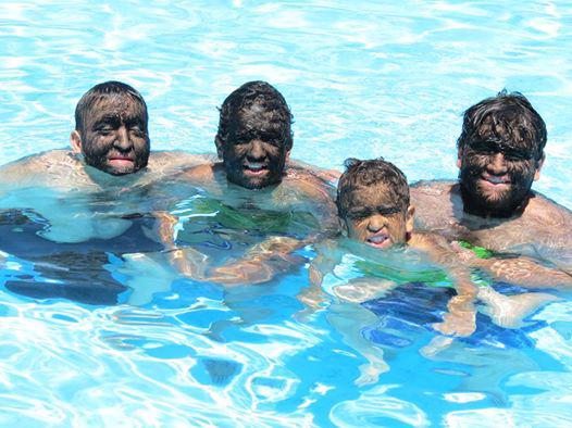 YouTube: Esta es la conmovedora historia del hombre lobo 