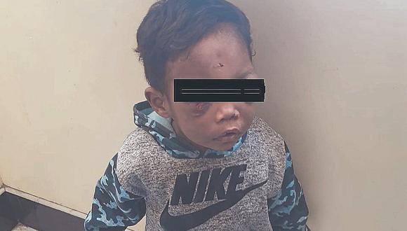 Fiscal pide 9 meses de cárcel para padrastro que golpeó a niño de tres años