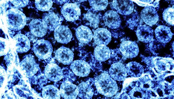 Esta foto del Instituto Nacional de Alergias y Enfermedades Infecciosas muestra una micrografía de transmisión de color de electrones de partículas del virus del SARS-CoV-2, aislada de un paciente. (Foto: AFP)