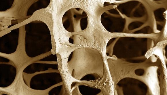 Osteoporosis: A prevenir con una buena alimentación