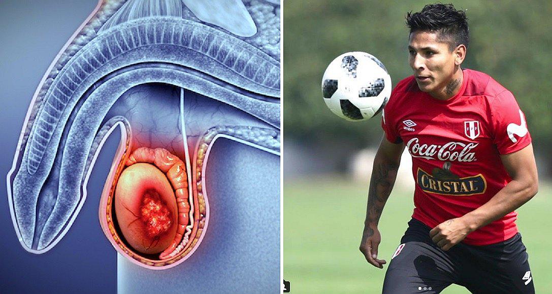 Raúl Ruidíaz se sumó a la campaña "Amo mis bolas" para prevenir cáncer testicular