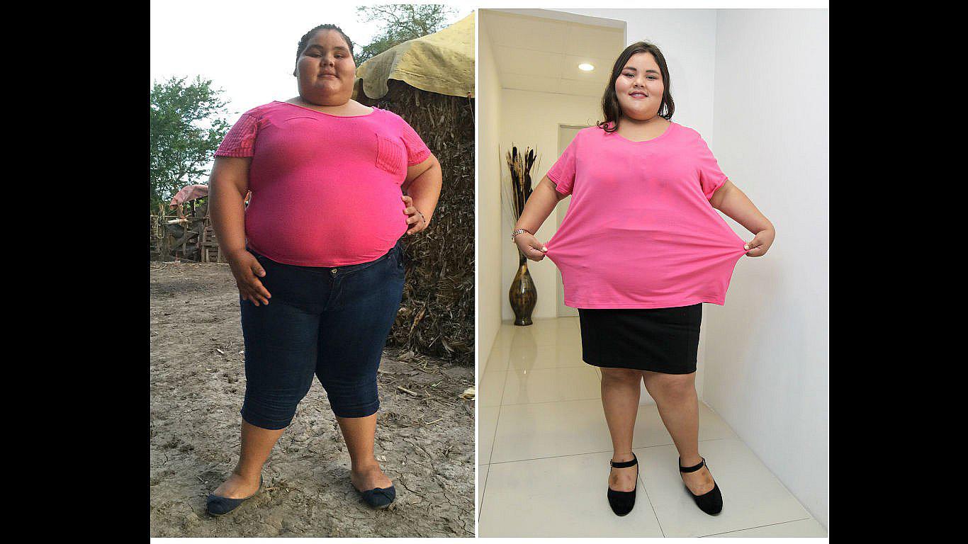 México: Menor bajó 90 kilos para su fiesta de 15 años