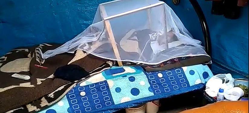 Bacteria ‘comecarne’ destruyó el rostro de una madre de familia (VIDEO) 