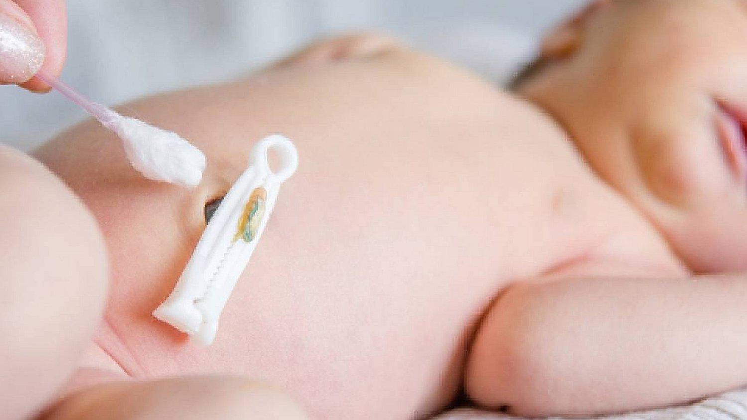 Preparativos para la llegada de tu bebé: ¿Qué es el 'clampaje' y cuál es su importancia?