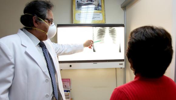 Con una muestra de esputo y radiografía puede determinarse si se padece de TBC. (Foto: Difusión)