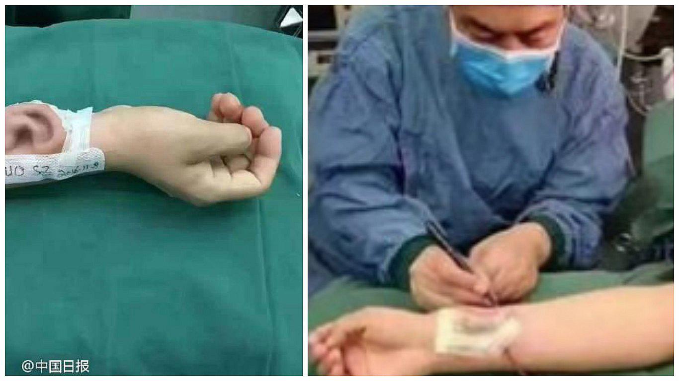 YouTube: este cirujano transplantó una oreja en brazo de paciente (VIDEO)
