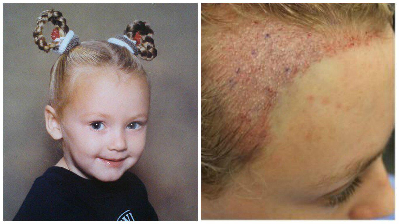 Esto es lo que sucede cuando te ajustas el cabello por años (FOTOS)