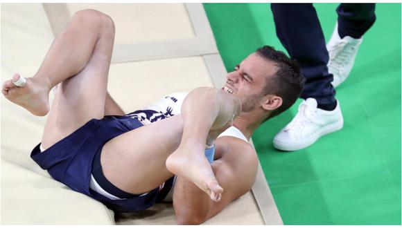 Río 2016: Gimnasta francés operado con éxito de la pierna izquierda 