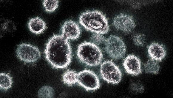 Según la investigación, el freno a la producción de proteínas reduciría la réplica viral del SARS-CoV-2 en células infectadas. (Cortesía / National Institute of Allergy and Infectious Diseases / AFP)