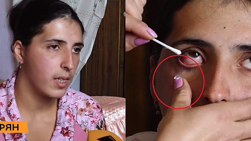 Ella es la mujer que “llora cristales” y que desconcierta a los médicos (VIDEO)