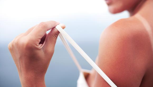 El cáncer no es la única enfermedad a la piel generada por el sol